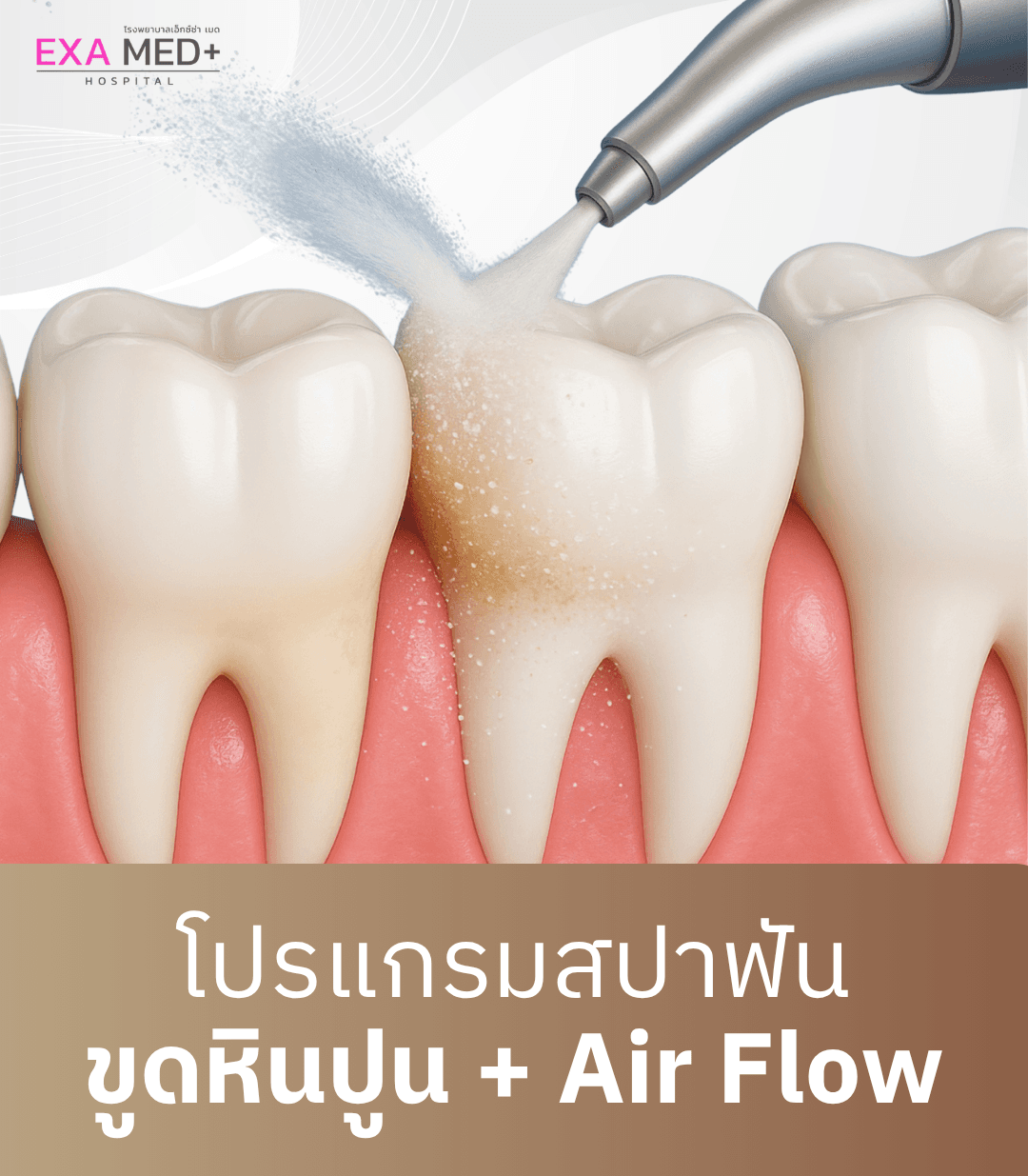 ขูดหินปูนพร้อม Airflow