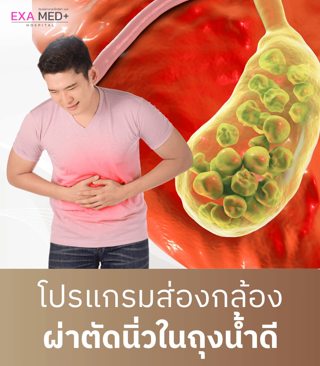 ผ่าตัดนิ่วในถุงน้ำดีผ่านกล้อง