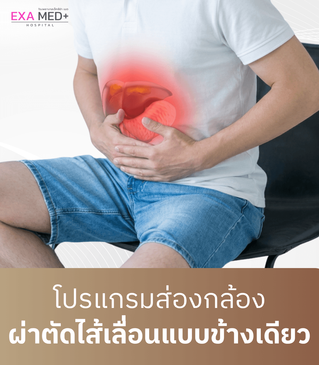 ผ่าตัดไส้เลื่อนข้างเดียว